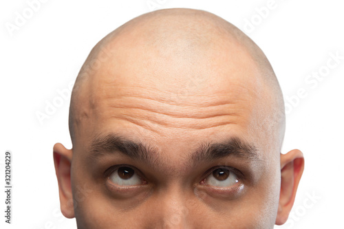 Photo of shaved man looking up, half head