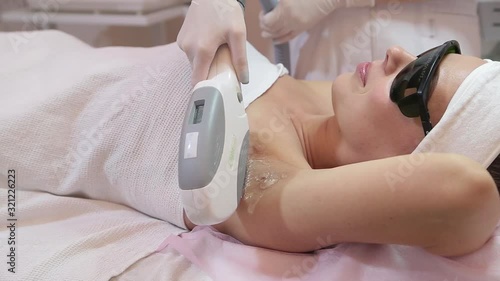 Having underarm laser hair removal epilation