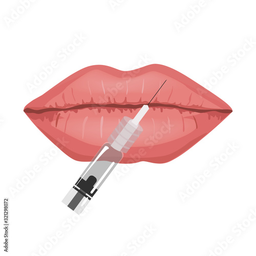 Lips filler injections concept, vector illustration. Lip augmentation. Hyaluronic Acid injections