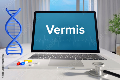 Vermis – Medizin/Gesundheit. Computer im Büro mit Begriff auf dem Bildschirm. Arzt/Gesundheitswesen