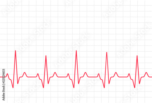 ECG heartbeat monitor, cardiogram heart pulse line wave. Electrocardiogram medical background
