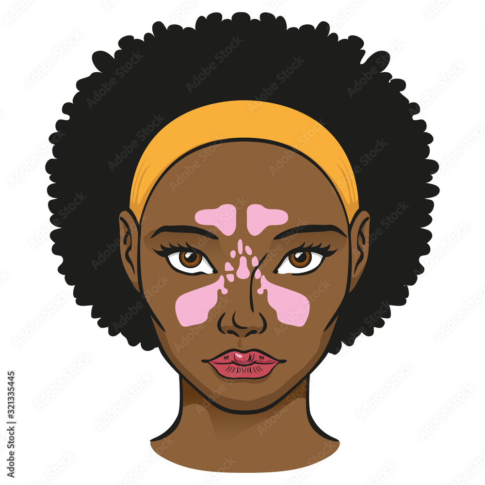 Illustration nasal cavity face, sinuses, black woman. Ideal for catalogs, newsletters and medicine and institutional