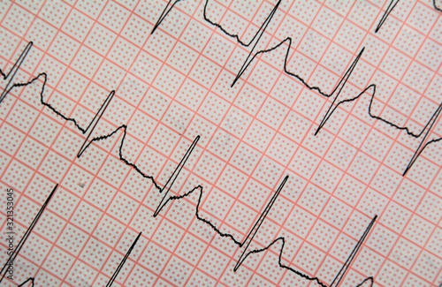 graphic line with the heartbeat EKG