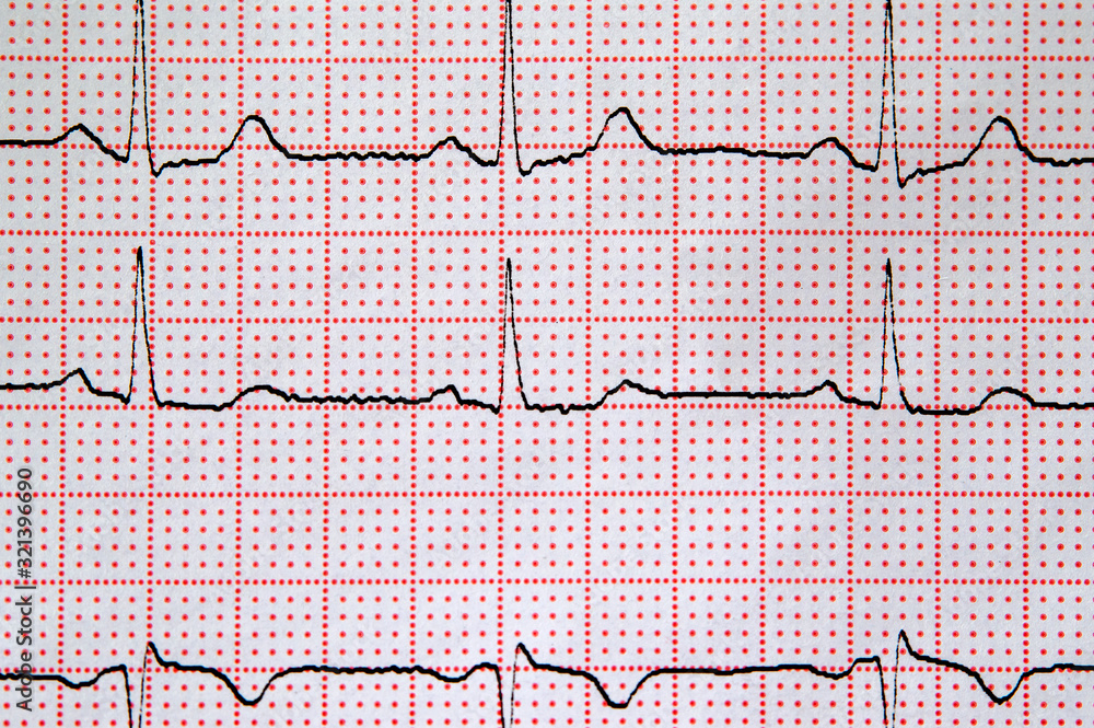 cardiogram, background image, selective focus