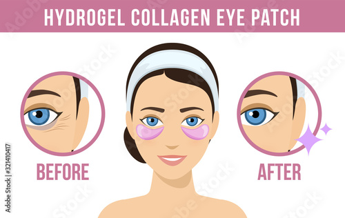 Before and after hydrogel eye patches. Cosmetic collagen eye patches. Pink eye patches for beauty and skin care. Vector