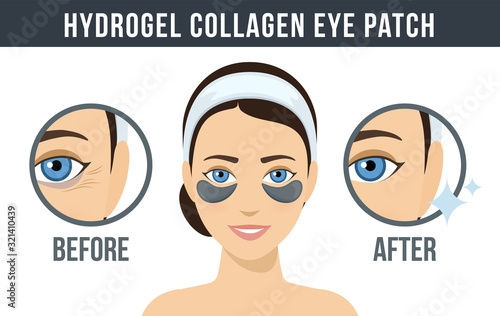 Before and after hydrogel eye patches. Cosmetic collagen eye patches. Black eye patches for beauty and skin care. Vector