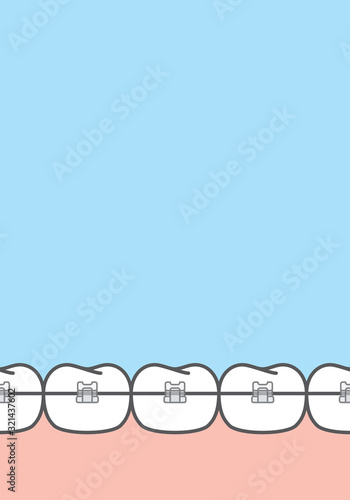 Blank banner Damon clear braces teetth illustration vector on blue background. Dental concept.