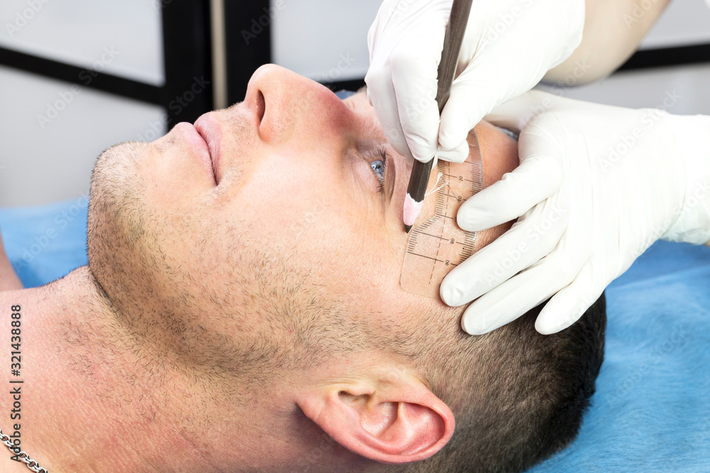 Fototapeta premium Male microblading procedure to improve the condition of a man’s eyebrows in a beauty salon.