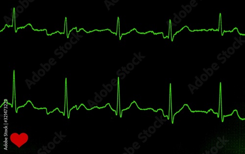 an EKG electrocardiogram with heart pulse