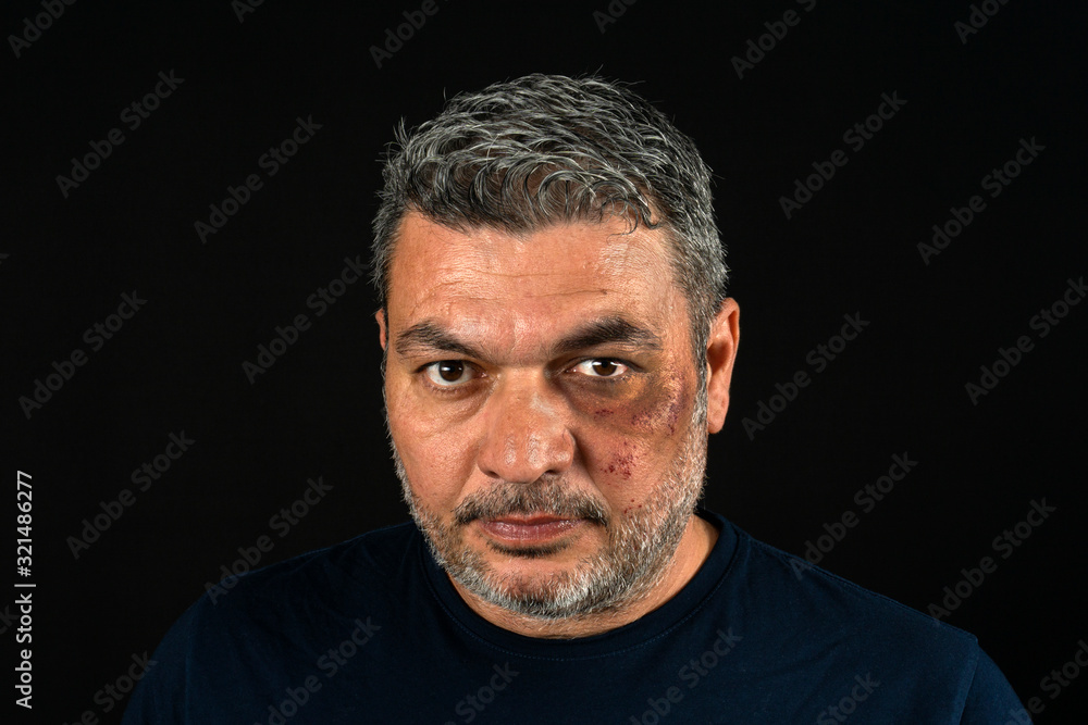 portrait of mature man with injured face portrait of mature man with injured face