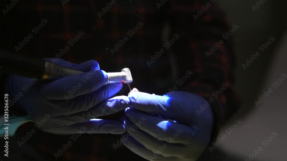 Students of dentists learn to fill the root canals of artificial teeth. Stomatlogists drill them and splatter to the sides. Students of dentists learn to fill the root canals of artificial teeth. Stomatlogists drill them and splatter to the sides.