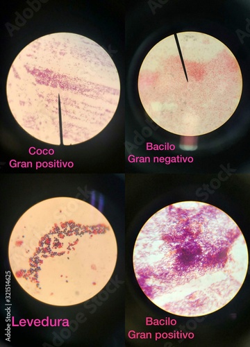 microbiology p1 photo