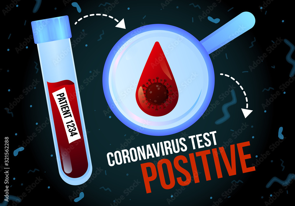 Positive coronavirus test infographics vector banner template Stock Positive coronavirus test infographics vector banner template Stock