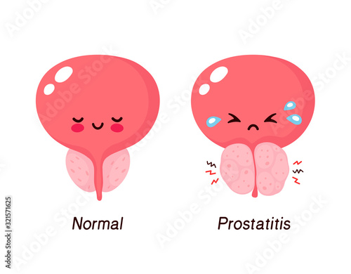 Normal prostate and benign prostatic hyperplasia photo