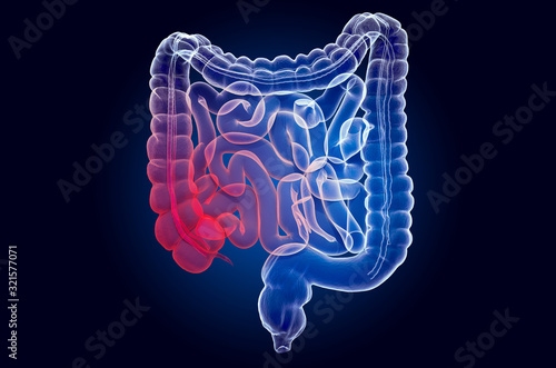 Pain in human intestines, bowel concept. Ghost light effect, x-ray hologram. 3D rendering