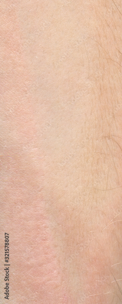 Fototapeta premium skin texture with a light shade of hair