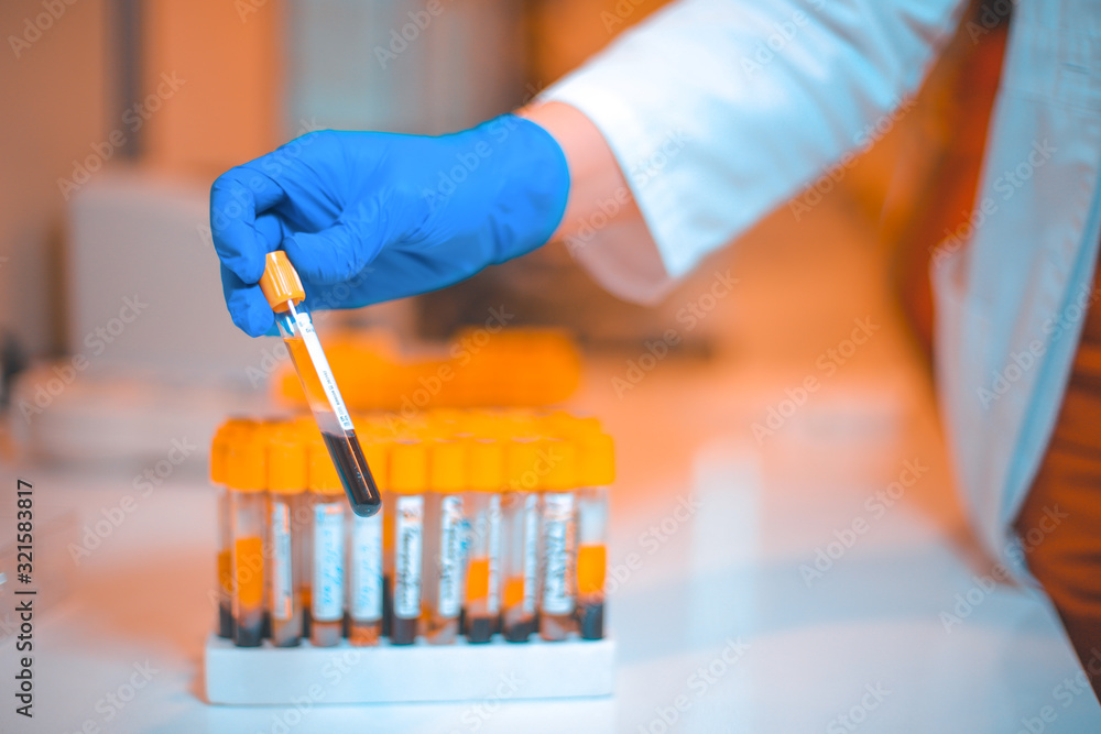Foto de Blood test tubes in centrifuge. Medical laboratory concept do
