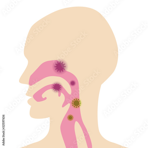 Anatomical human body diagram for Respiratory system - throat and nasal cavity , infected with virus