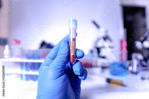 female doctor holding a blood sample tube in her hand in the laboratory.