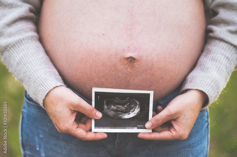 A pregnant woman is holding a photo of her baby Ultrasound , outdoors . A pregnant woman is holding a photo of her baby Ultrasound , outdoors .
