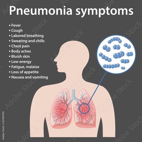 Pneumonia. Image of human body and lungs infected Streptococcus pneumoniae bacteria. Pneumonia symptoms. Vector illustration in flat style over black background.