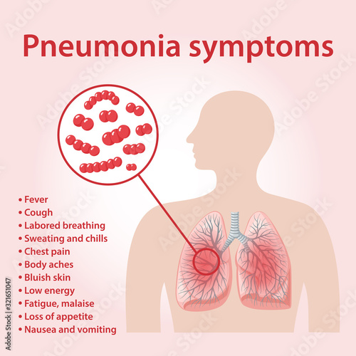 Pneumonia symptoms. Image of human body and lungs infected Streptococcus pneumoniae bacteria. Vector illustration in flat style over pink background.