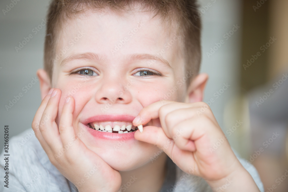 Teenager child with a tooth dropped out Teenager child with a tooth dropped out