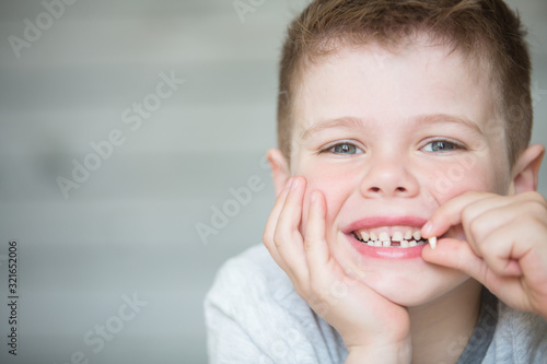 Teenager child with a tooth dropped out photo