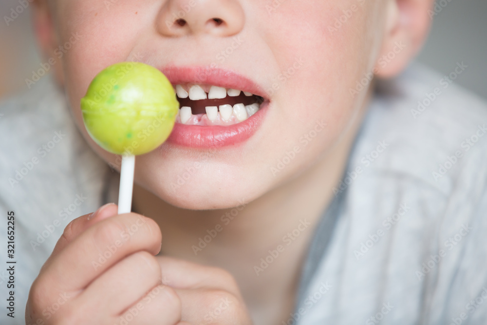 Teenager child with a tooth dropped out Teenager child with a tooth dropped out