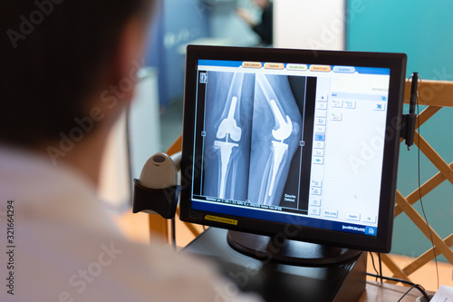 Service radiologie médical manipulateur controle radio prothèse de genou sur écran ordinateur photo