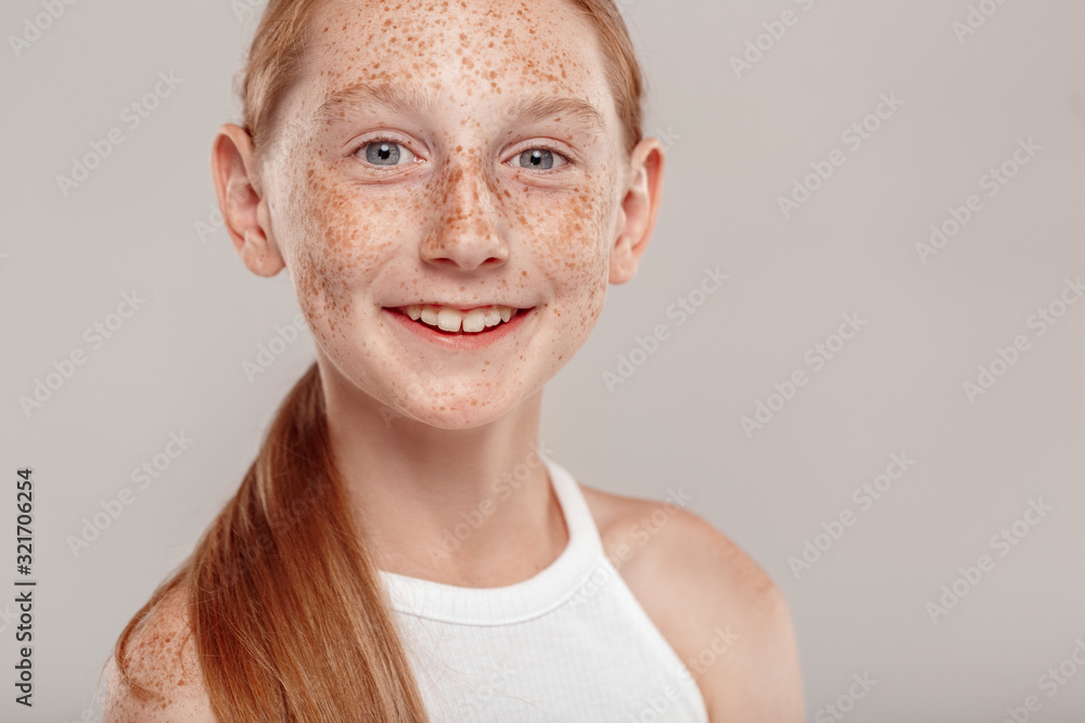 Inclusive Beauty. Girl with freckles standing isolated on grey smiling excited close-up Inclusive Beauty. Girl with freckles standing isolated on grey smiling excited close-up