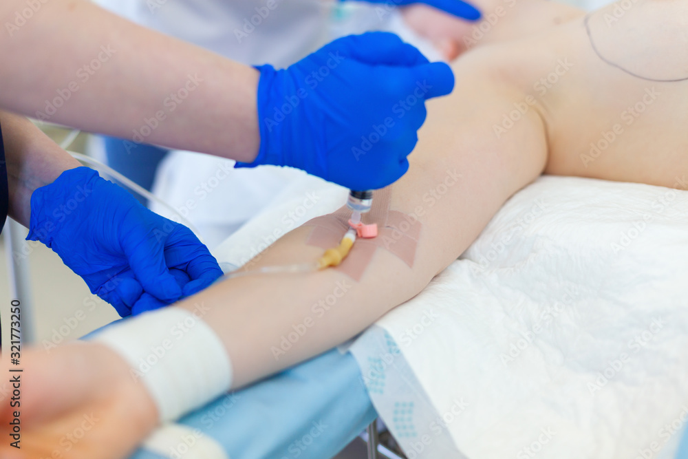 Hospital. Surgeon operates in the operating room. Insertion of a peripheral venous catheter before the operation and giving anesthesia Hospital. Surgeon operates in the operating room. Insertion of a peripheral venous catheter before the operation and giving anesthesia