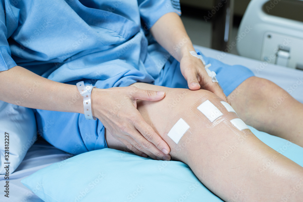 Leg of pcl ligament knee surgery patient lying on bed in ward at hospital with sterile bandage plaster on wound. Leg of pcl ligament knee surgery patient lying on bed in ward at hospital with sterile bandage plaster on wound.