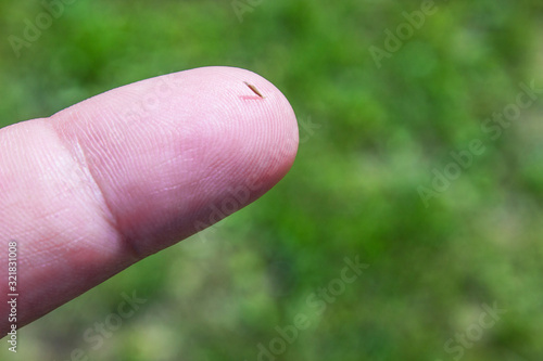 A splinter in the finger close up. photo