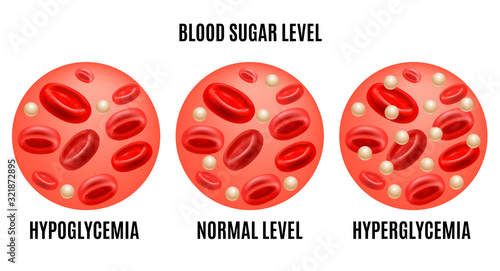 Realistic Detailed 3d Glucose Blood Level Ad Poster Card. Vector photo