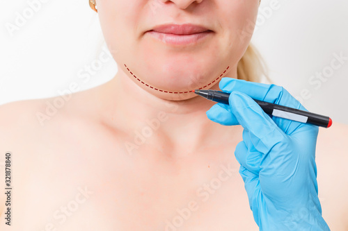 Chin reduction augmentation double chin removal plastic surgery cosmetic operation concept Woman eyes closed waiting doctor surgeon hands to draw the cut line the double chin isolated white background photo