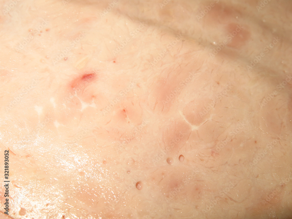the texture of the ham for the background, cold surface