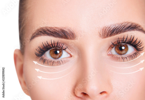 Lifting arrows on eyes show anti wrinkles treatment on skin.