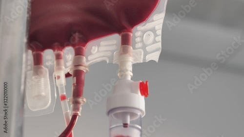 Close up footage of a bag of blood at the blood transfusion department, the shot is moving from the top to the bottom