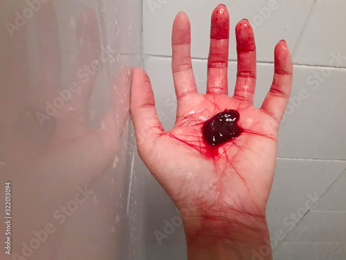 Hand stain Deep red blood clot in hand Symptoms of hemorrhage are life threatening When there is blood flowing out of the body, should seek medical attention to treat. photo