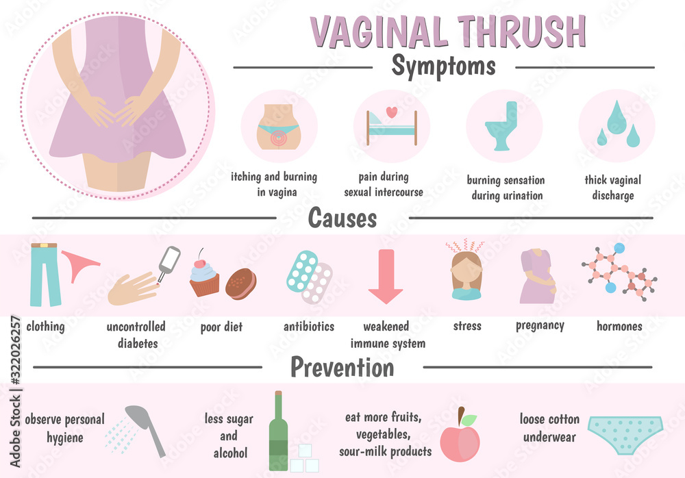 Vaginal Thrush Candidiasis Vaginal Infection Causes Symptoms