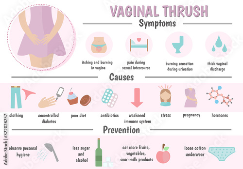 Vaginal thrush, candidiasis. Vaginal infection. Causes, symptoms, prevention. Medical infographics, Vector illustration.