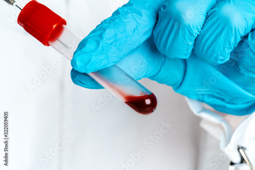 Doctor in blue gloves keep in hands test tube with a blood and syringe