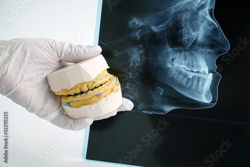 .diagnostics in the course of orthodontic treatment