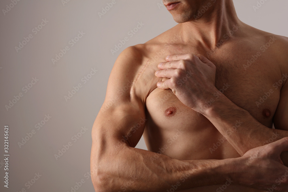 Muscular Man with scar on his shoulder after Surgery. Laser Scar Reduction concept, Sport exercising Injury Muscular Man with scar on his shoulder after Surgery. Laser Scar Reduction concept, Sport exercising Injury