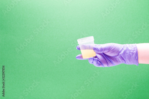 hand in a disposable medical glove holds a jar for analysis with urine, green background, copy space