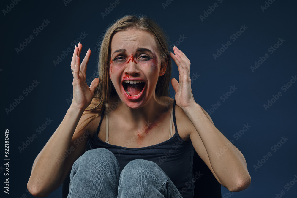 Young girl, bleeding face covered with bruises, in black t-shirt and jeans,  screaming, crying, sitting on blue background. Domestic abuse. Close-up  Stock-Foto | Adobe Stock