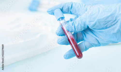 hands of a lab technician with a tube of blood sample / lab assistant holds a blood test tube for research. The taking of biological material to identify the virus, the flu. Copy  space