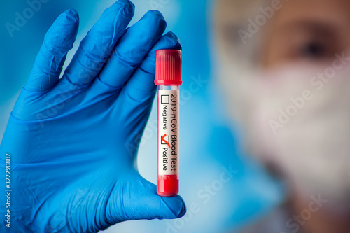 Female doctor holding test tube with blood. Coronavirus, epidemic and healthcare concept