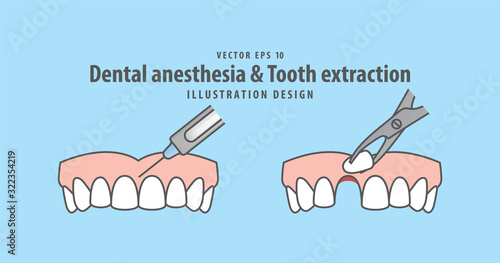 Dental anesthesia,a syringe injecting to gums & Tooth extraction,tooth removal by forceps illustration vector design on blue background. Dental care concept.